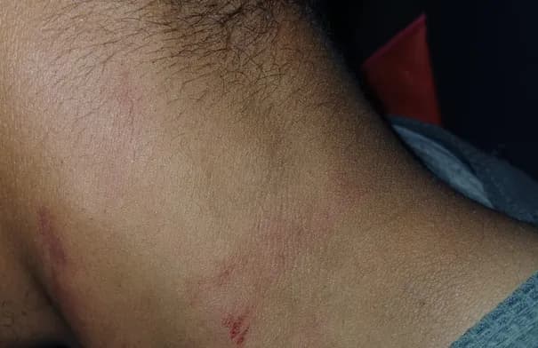 Patriot Worker Attacked in Irbid