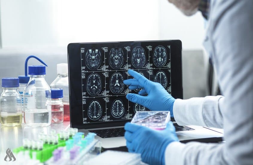 Alzheimer's blood vessel damage mechanism found