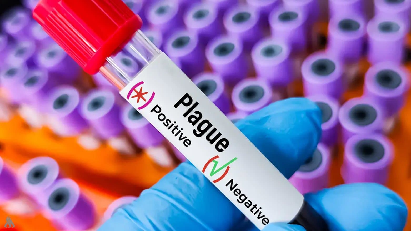 White House Watches Potential Russian Plague