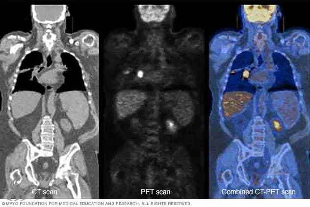 New CT scans provide full body images