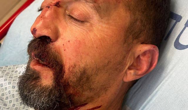 حادث عنصري يُصيب سائق حافلة بجبل المكبر