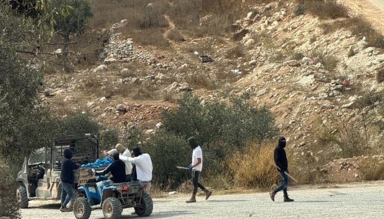 مواطن مصاب برصاص المستوطنين في أوصرين