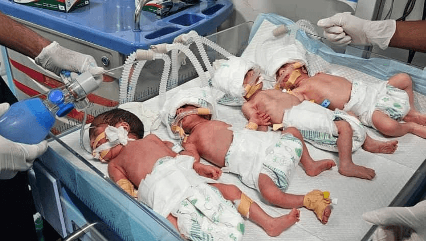 Emergency C-section saves mother and quadruplets