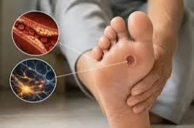 Nighttime diabetes signs on feet