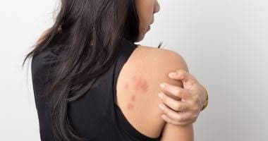 Is liver the cause of itching