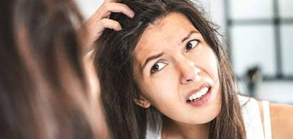 أسباب فطريات فروة الرأس وطرق العلاج