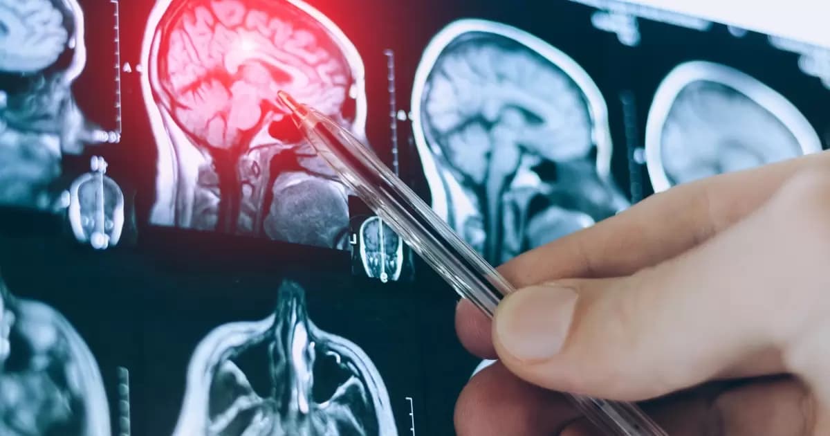 Blood test aids in detecting hidden brain injuries