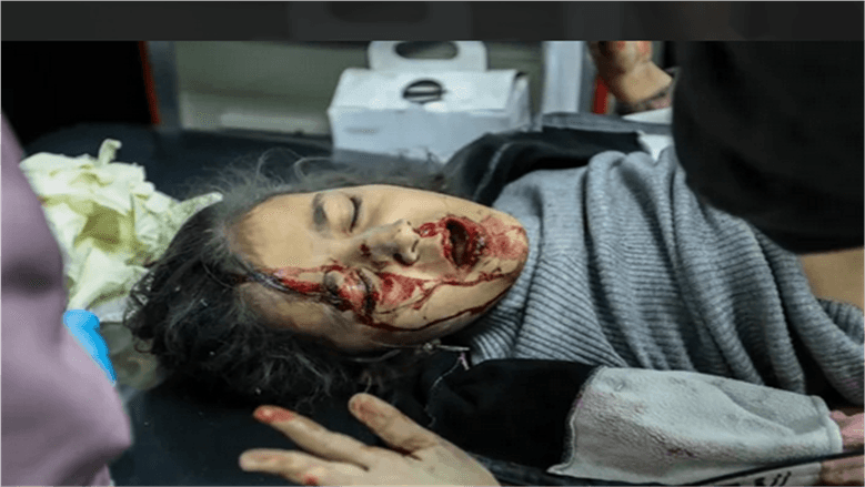 Israeli Strikes on Gaza Mark Anniversary