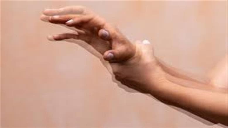 Reasons for Hand Tremors
