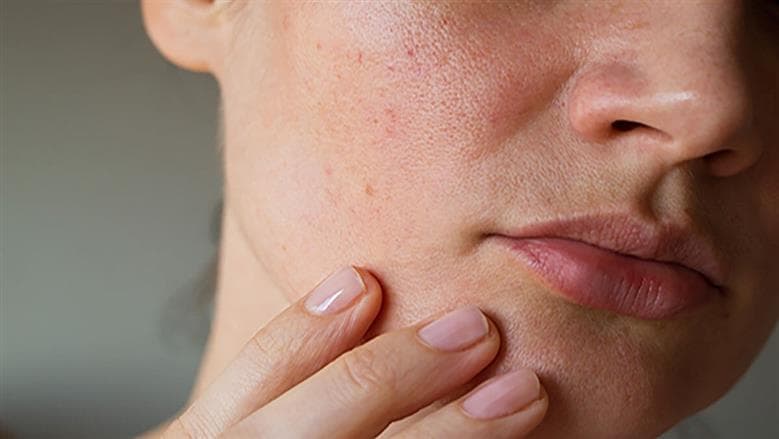 Best evening routine for dry skin