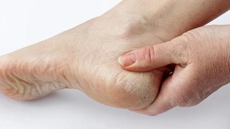 Relieving Foot Sole Tightness While Walking