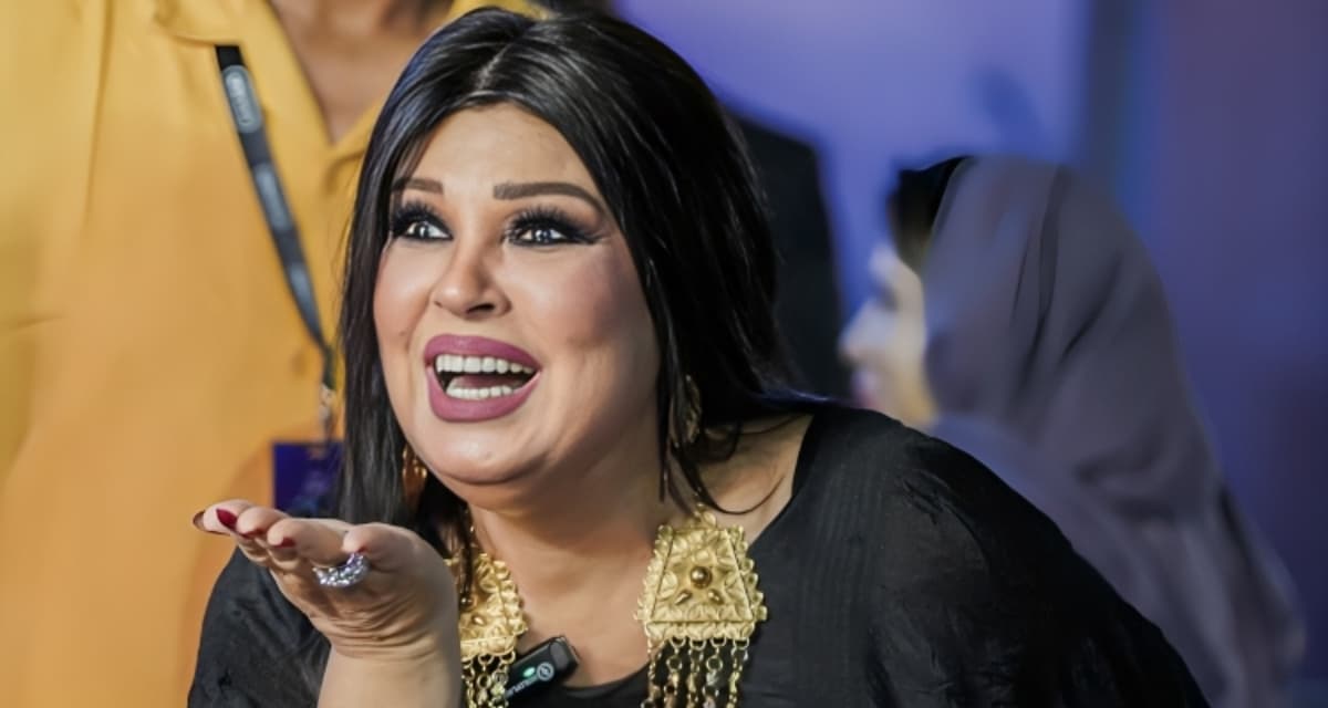 فيفي عبده تكشف تفاصيل إصابة ساقها