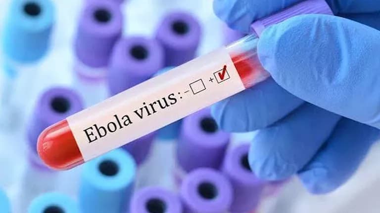 Ebola outbreak raises concerns in Kenya