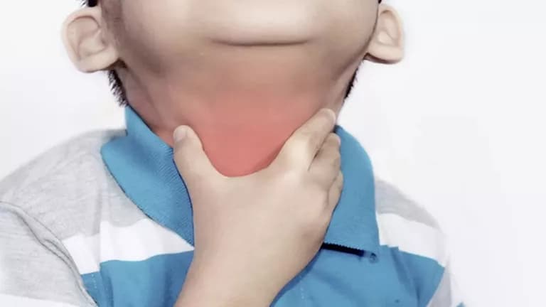 ما هو الاختناق الحنجري علامات الإصابة