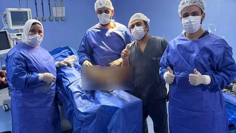 بلبيس ينجح في تثبيت كسور مضاعفة