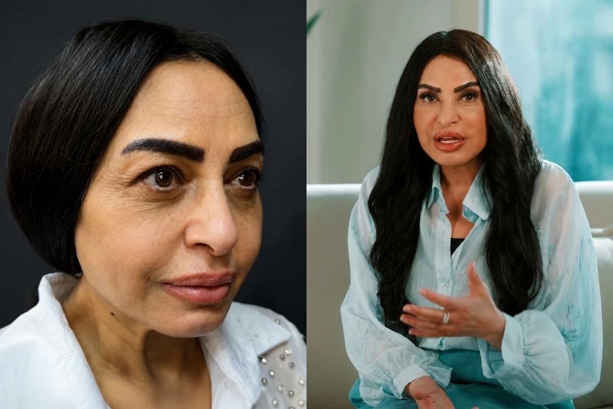 Salwa Khattab discusses cosmetic procedure