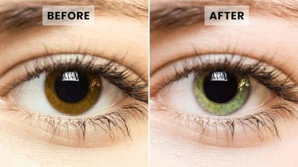 Eye color change dispute between Dar Al-Iftaa and doctors