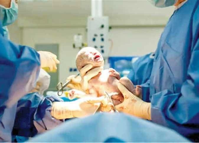 وزير الصحة يدعو لتغيير مفاهيم الولادة القيصرية