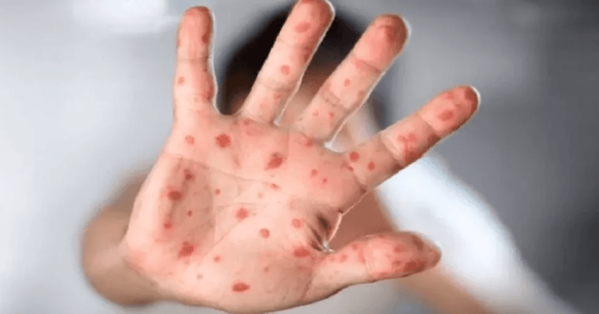 Gaza at risk of epidemics