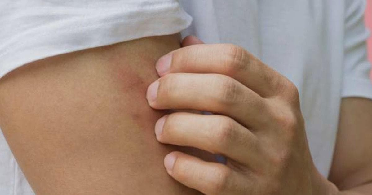 Reasons mosquitoes prefer certain people