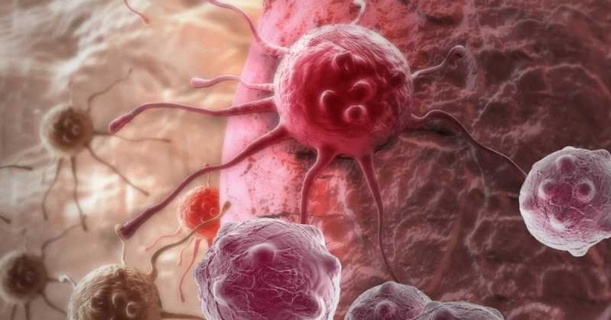 Signs That May Mask Cancers