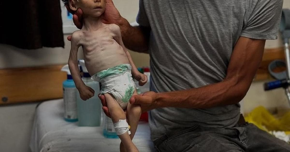 غزة وزارة الصحة: نقص الغذاء يهدد 74 ألف طفل