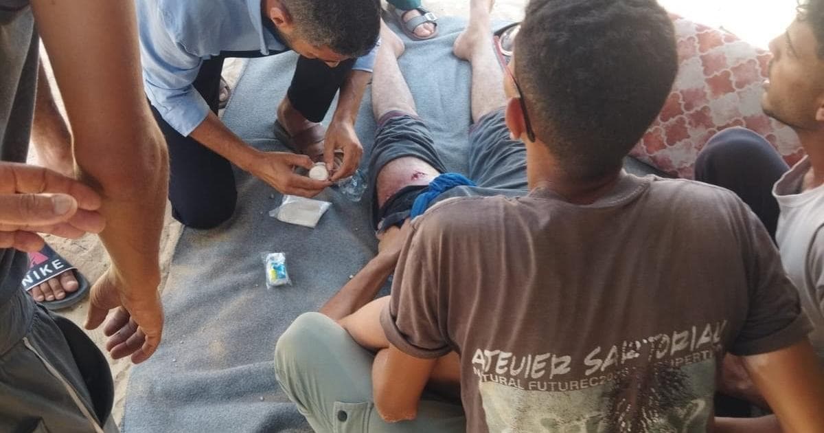 Child wounded in Gaza gunfire