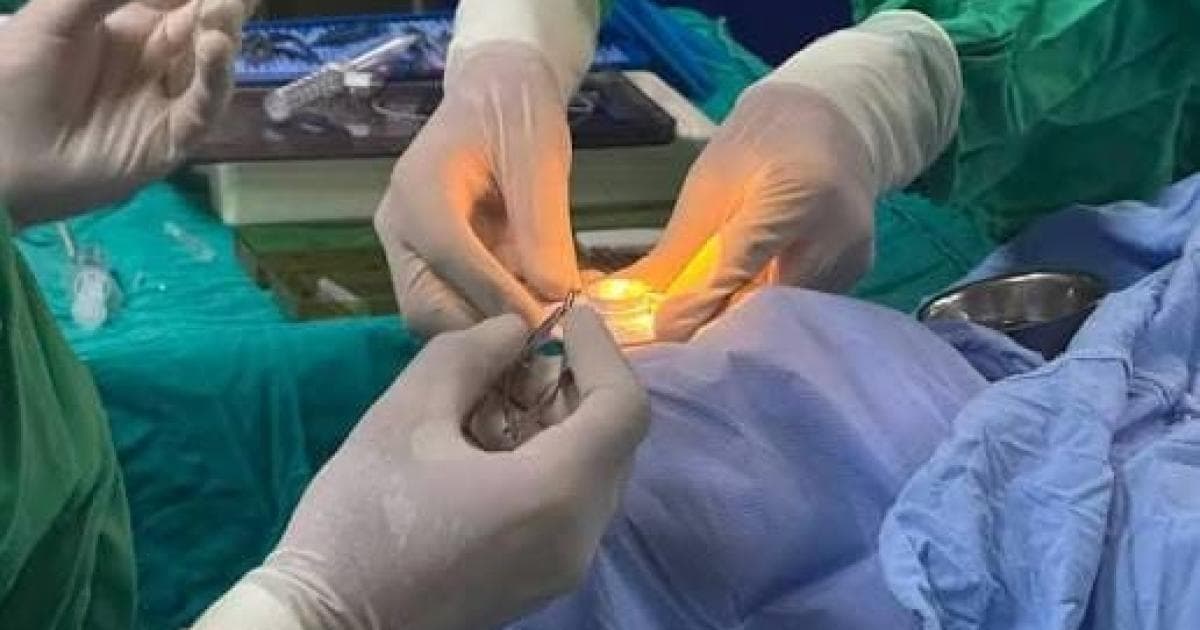 Gaza achieves successful cornea transplant
