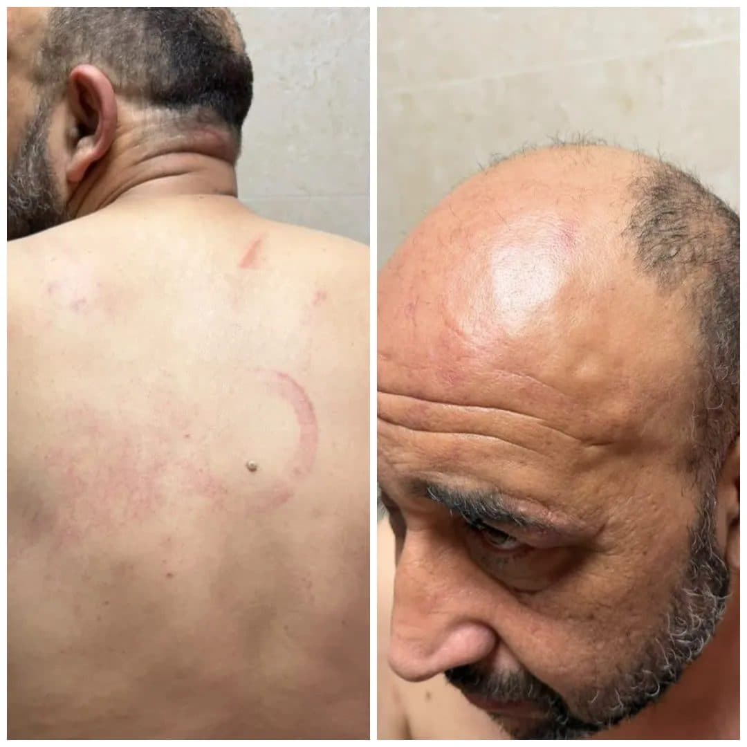 3 ضباط حاولوا قتلي بنظارة جنين