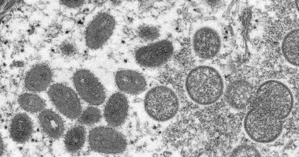 كندا تبدأ اختبار لقاح mRNA ضد إيبولا