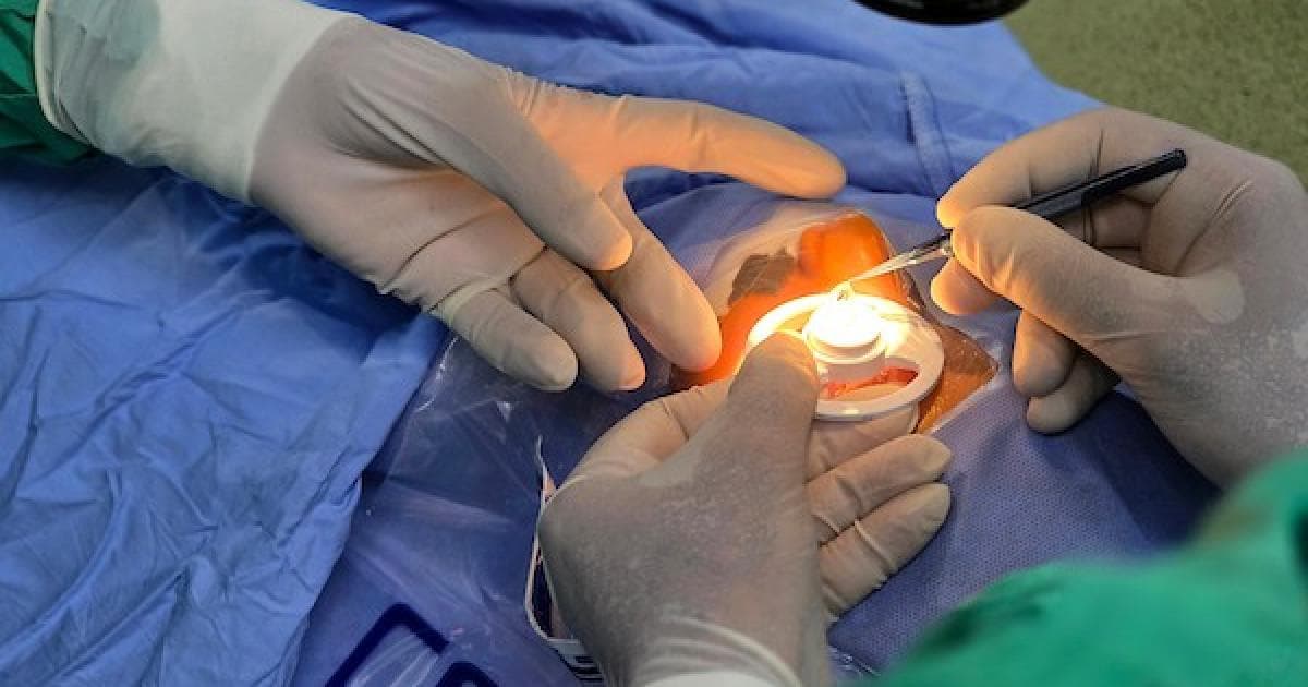 Corneal transplant for 12-year-old at Nasser