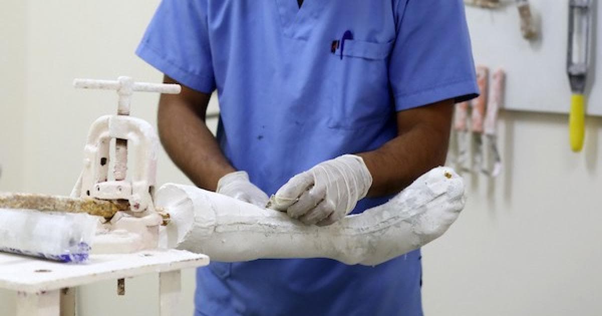Palestinian specialists produce prosthetics for war victims