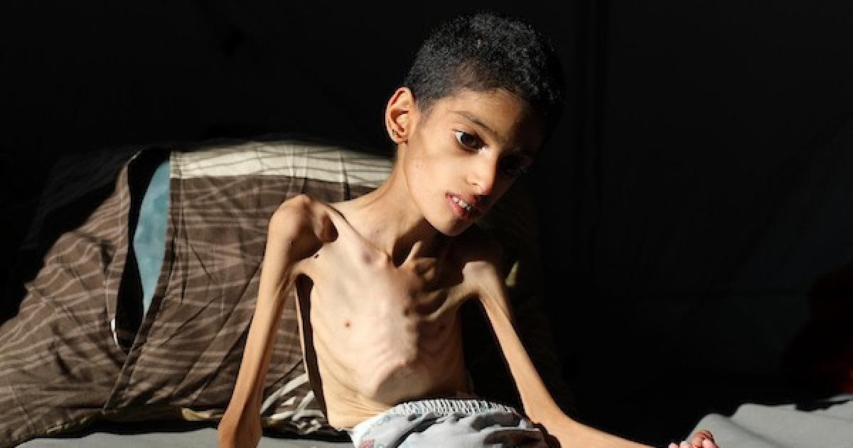 Save Ibrahim Gaza child seeks aid