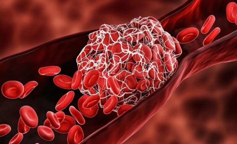 طبيب أعصاب يحذر من أطعمة تسبب الشلل والموت