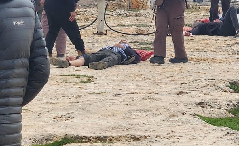 Child injured in Mufasser Yatta assault