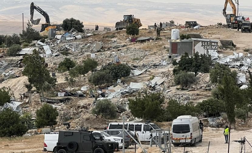 Citizen hurt in Yatta settler attack