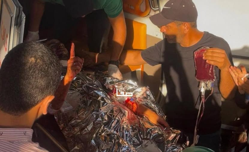 Israeli Shelling Injures in Gaza