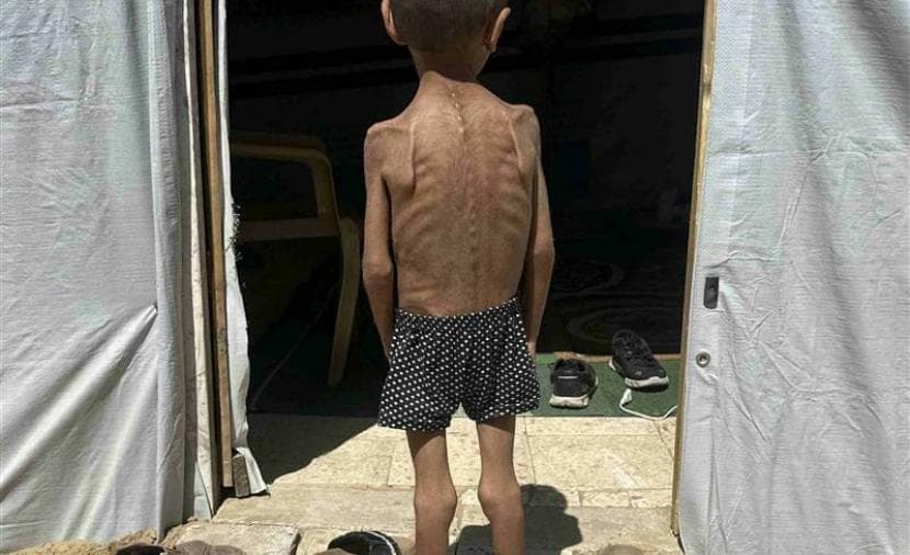 تقرير دولي عن وضع أطفال غزة
