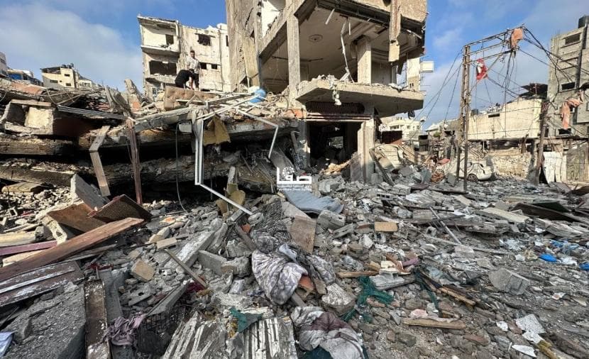 Gaza shelling causes casualties
