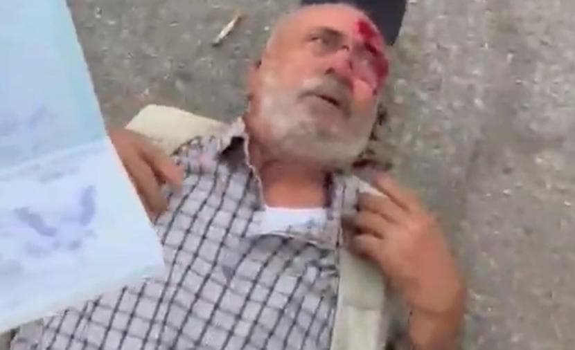 مسن يتعرض لاعتداء من الاحتلال شمال رام الله