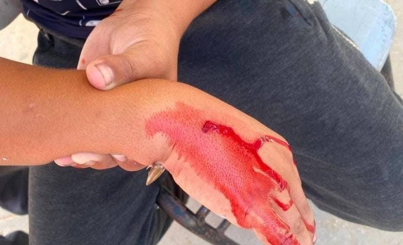 طالب يُصاب بنيران الاحتلال غربي غزة