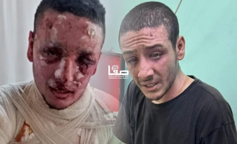 يحيى يدخل العشرينيات ببصره المهدد