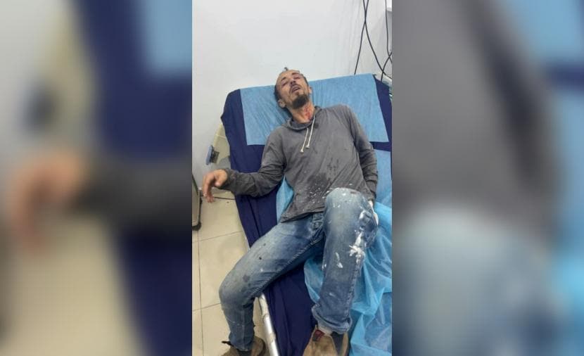 Citizen harmed in Tarmasaia settler attack