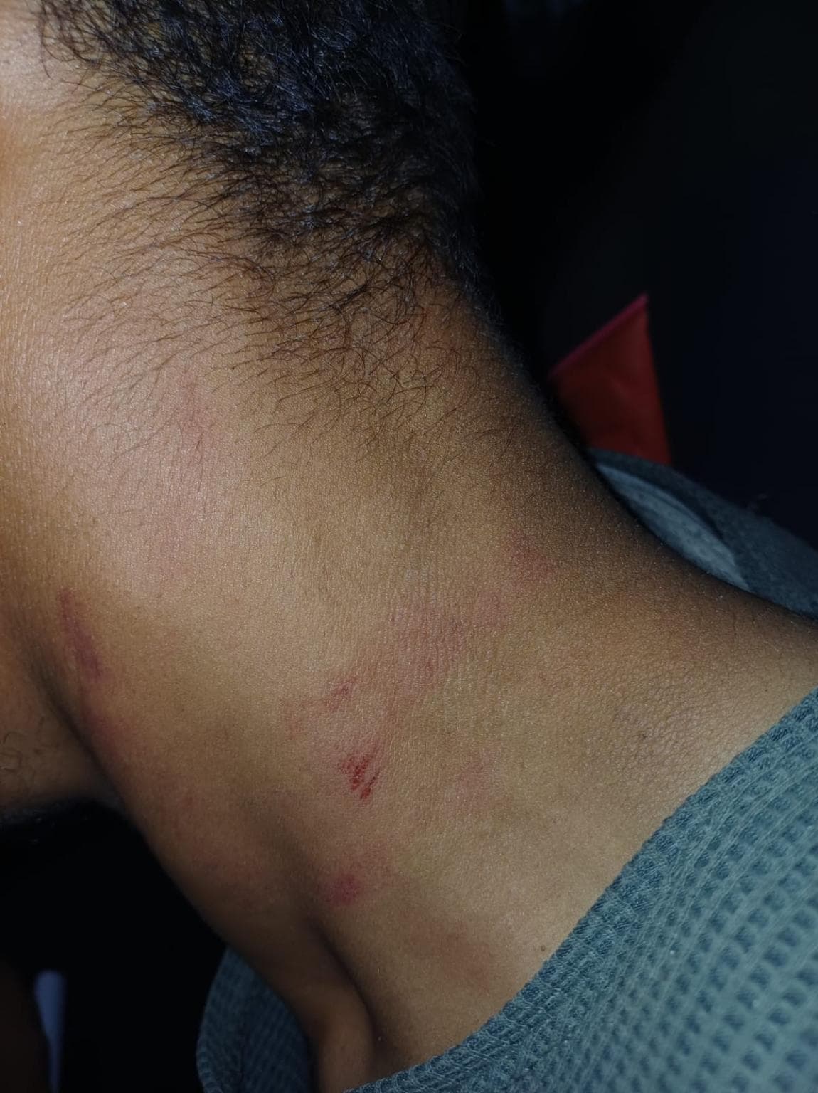 Irbid municipal worker assaulted