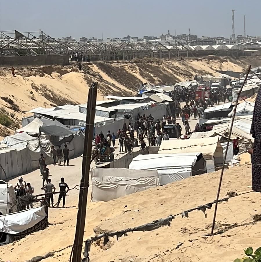 Fire-related injuries in southern Gaza