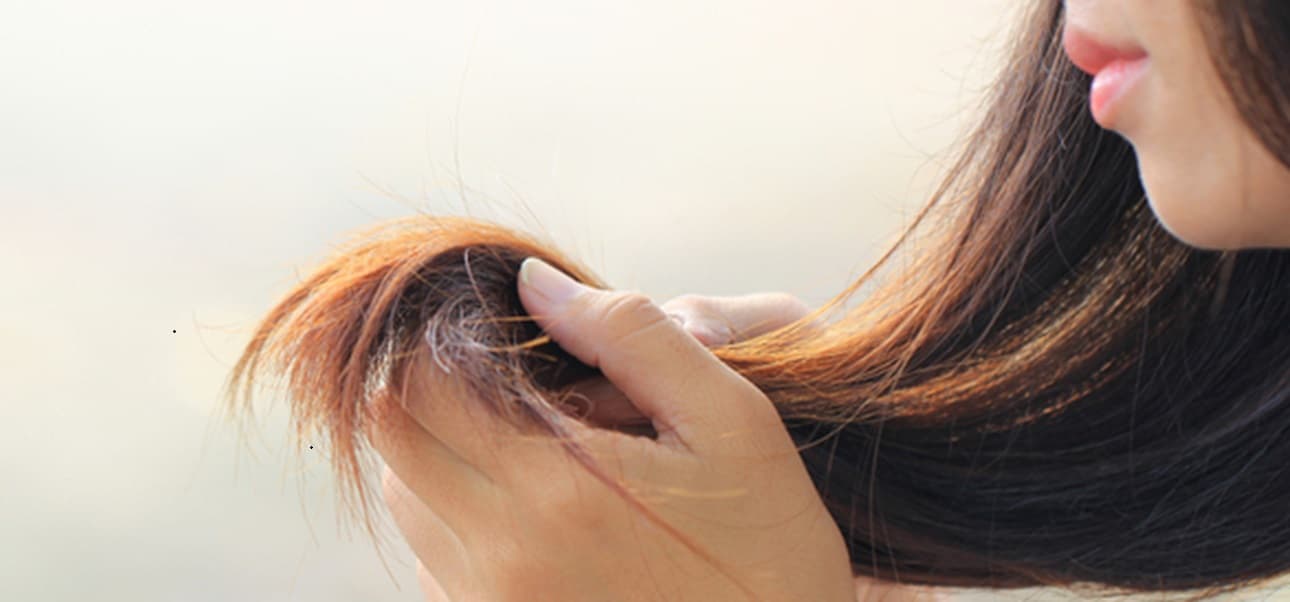 Why Many Lack Hair Despite Income