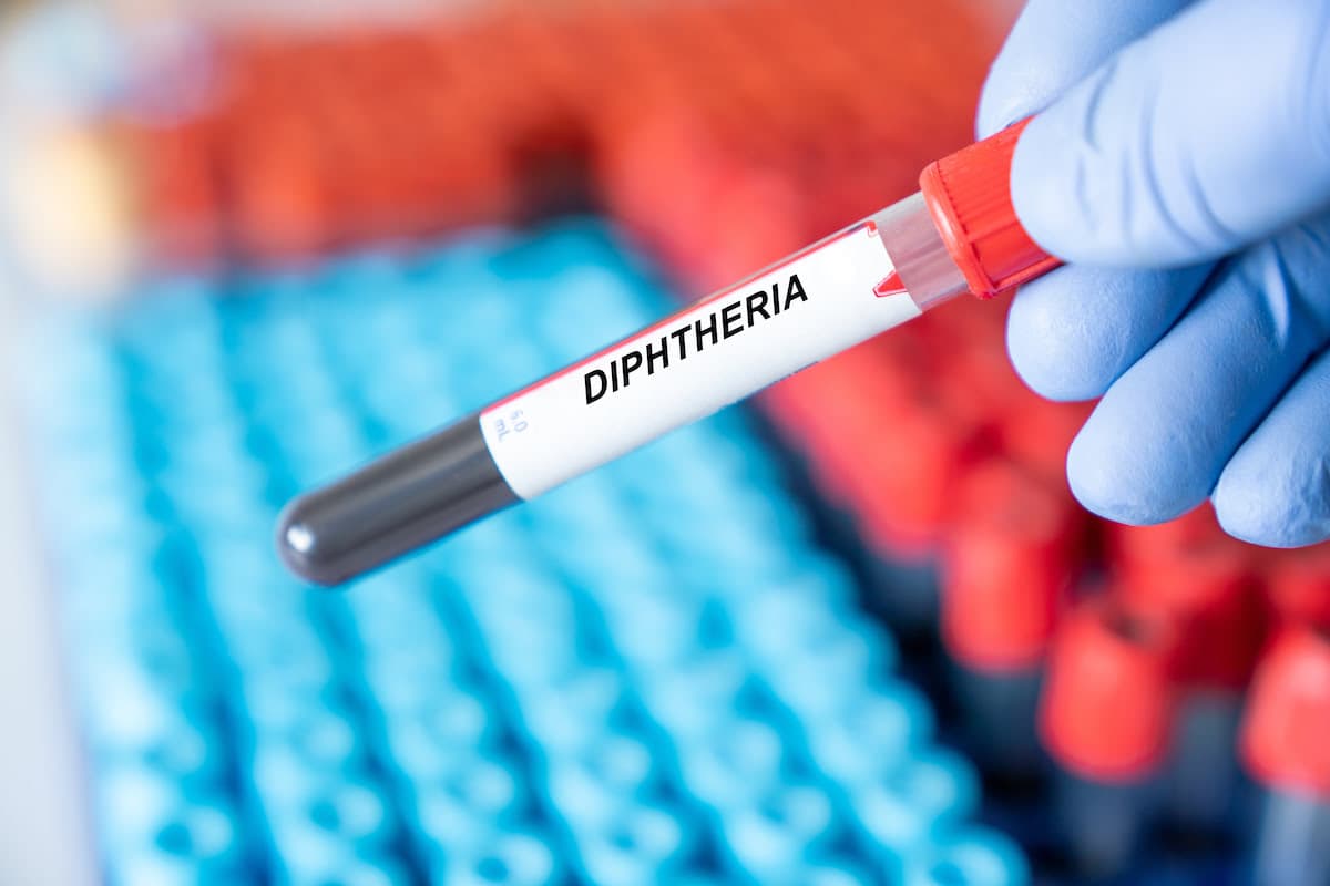 Morocco reports diphtheria clusters in Souss