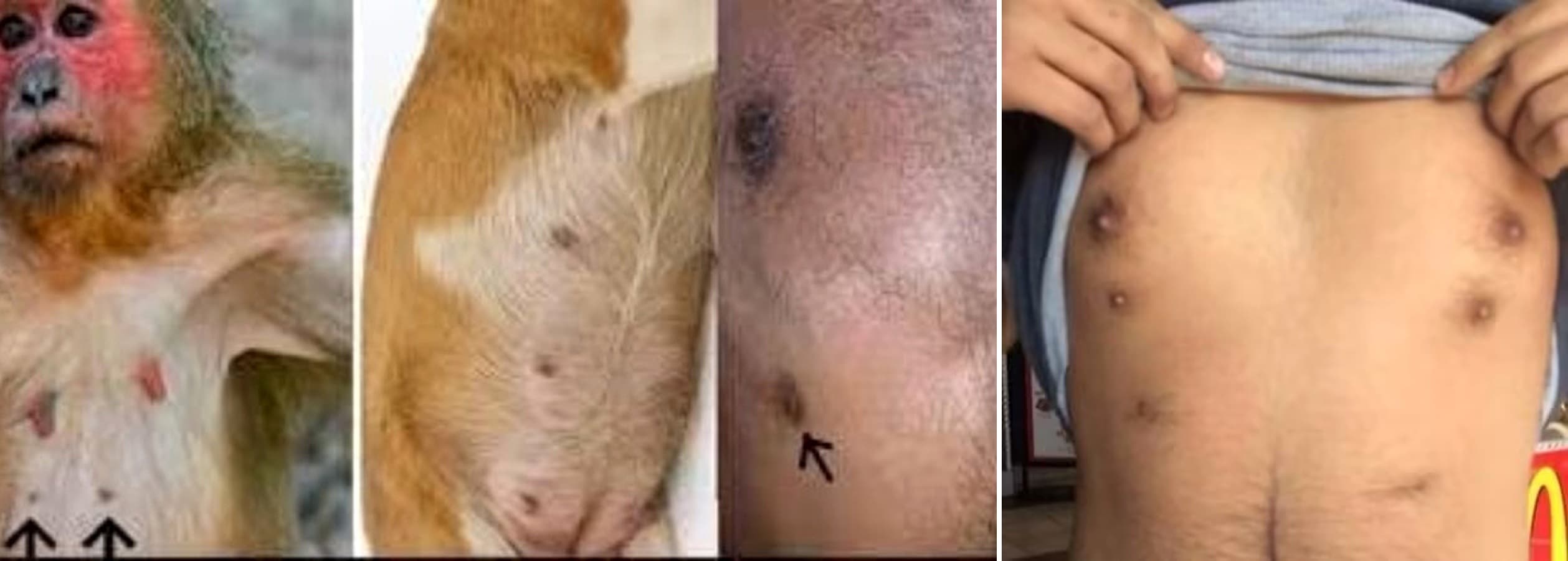 سبب كثرة البزازل عند بعض الناس