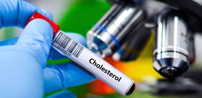 High Cholesterol Risks After Forty