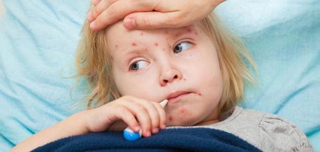 NY Declares Emergency Over Measles